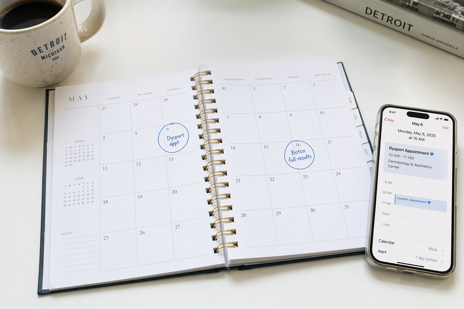 May calendar with Dysport and Botox appointment dates circled next to a smartphone showing a treatment reminder